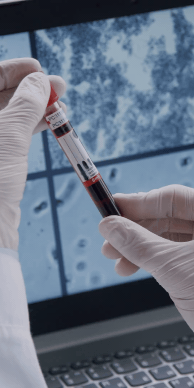 Forcells®️