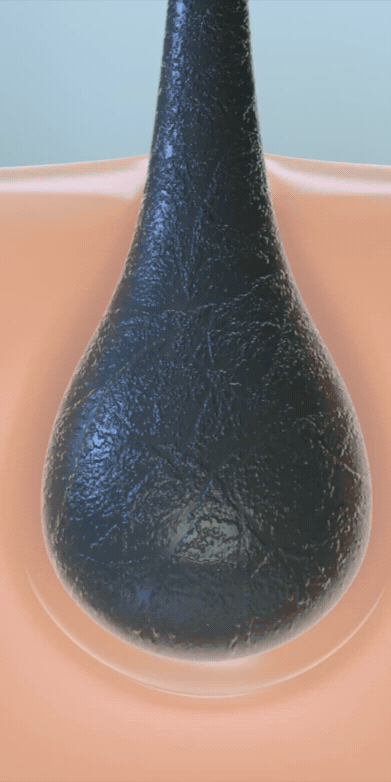 Forcells®️ Treatments - Hair Restoration